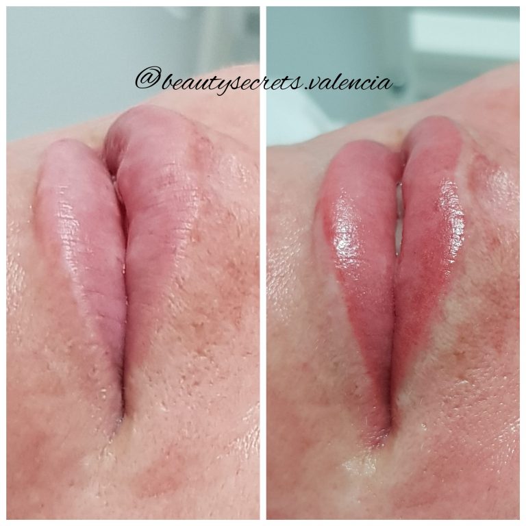 micropigmentación