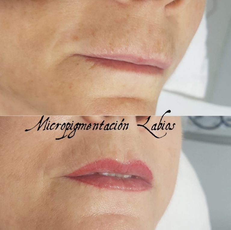 micropigmentación